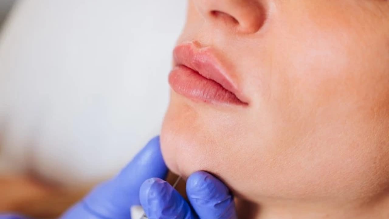 Dermal Fillers