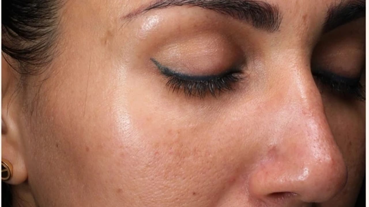 Growth Factor Induced Therapy™ after