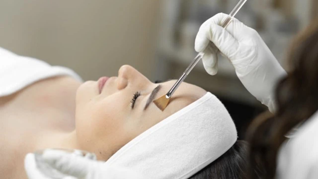 Chemical peel treatment for improving skin texture and tone
