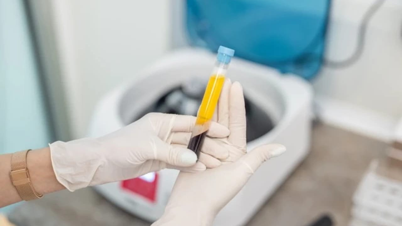The Golden Glow-Palette-Rich Plasma (PRP) treatment for natural skin and hair rejuvenation