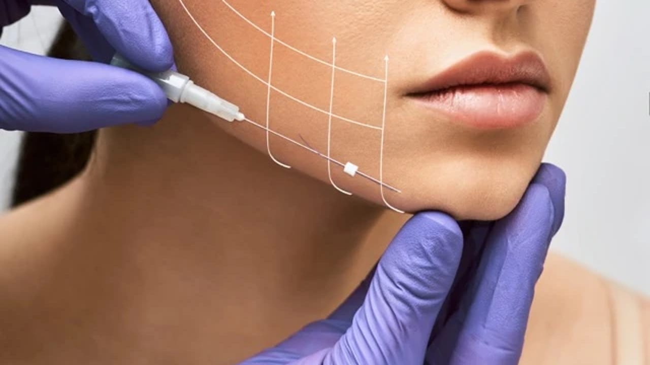 Threads and Thread-Lifting Procedures