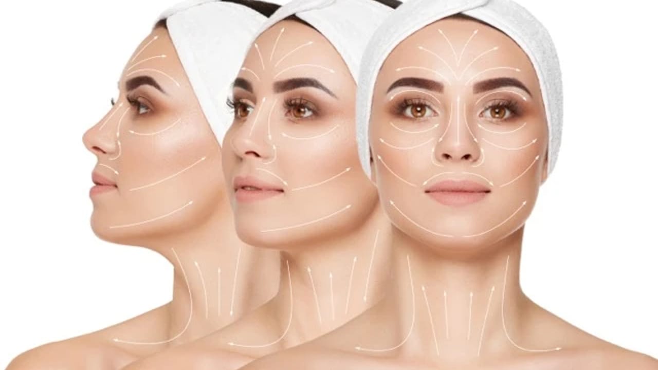 Facial contouring using anti-wrinkle injections