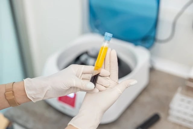 The Golden Glow — Platelet-Rich Plasma (PRP)